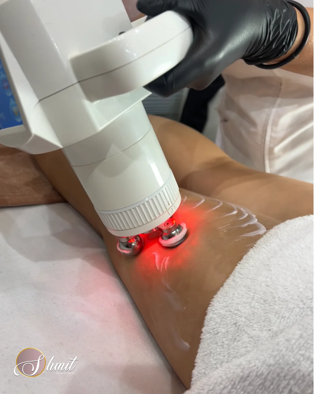 Aplicación de tecnología de estética corporal avanzada en Shmit Beauty Salon, Centro Comercial Alcalá Norte Madrid