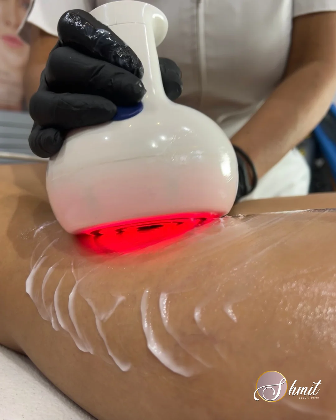 Especialista aplicando tratamiento corporal con equipo de tecnología estética en Shmit Beauty Salon Madrid
