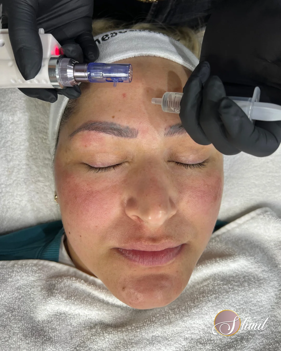 Especialista aplicando tratamiento facial con aparatología en Shmit Beauty Salon Madrid